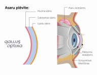 Asaru plēvītes sastāvs