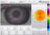 Параметры топографии левого глаза
